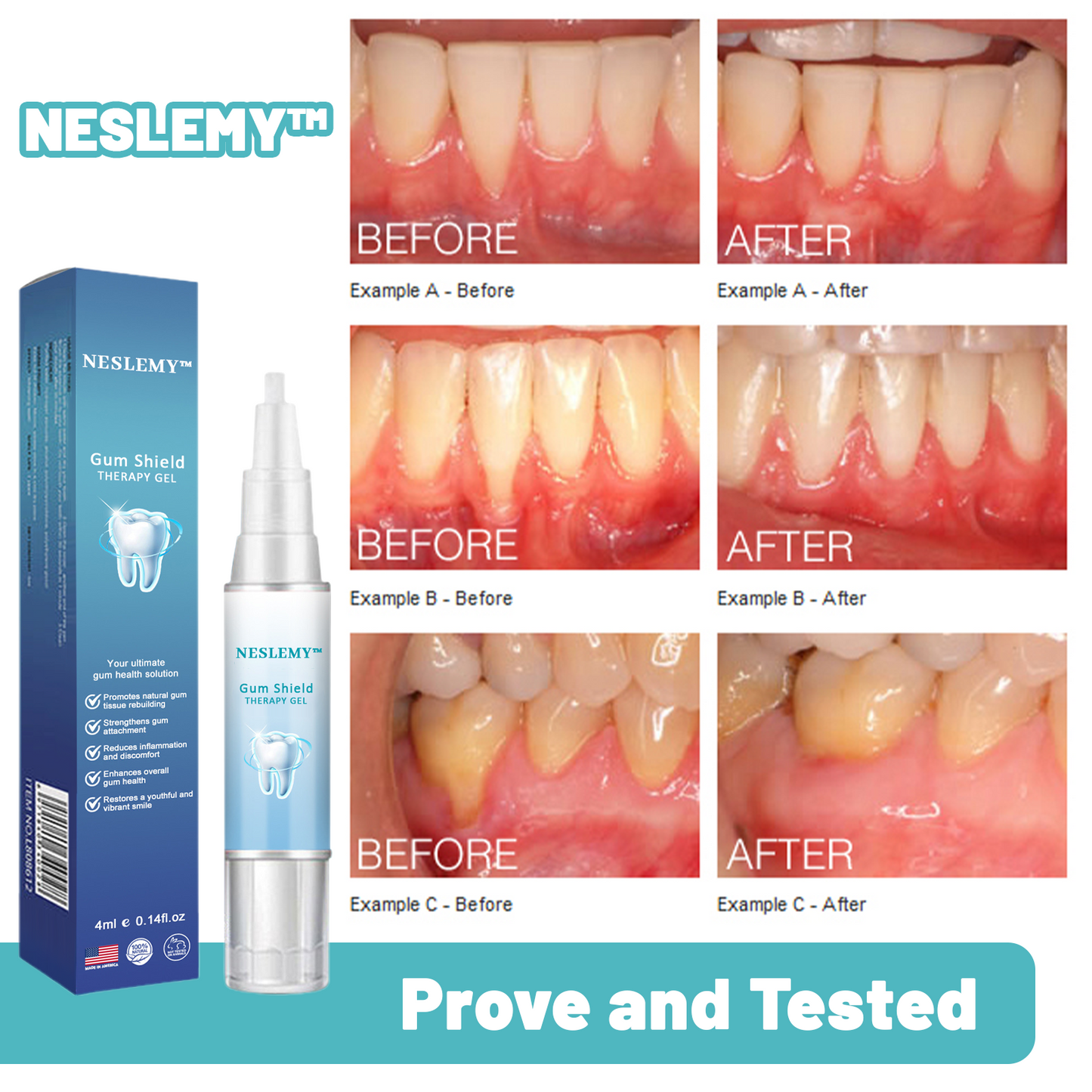 🦷🔥Last Day Promotion 80% OFF-NESLEMY™ Gum Shield Therapy Gel