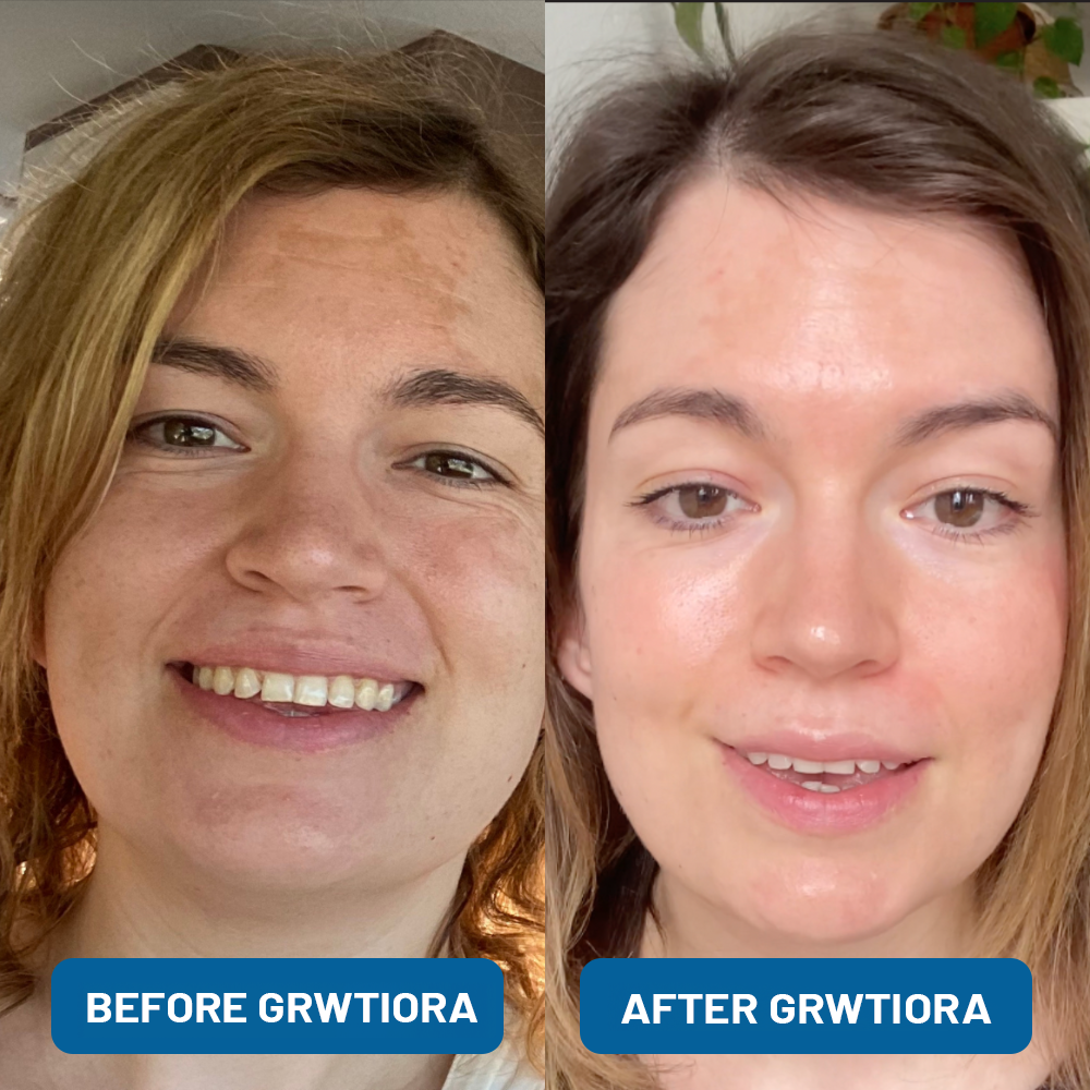 3% Hyaluronic Acid Ultra Hydrating Serum
