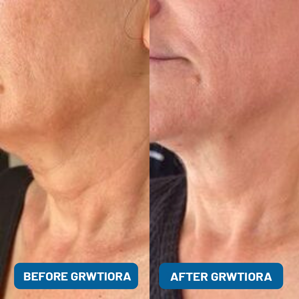 3% Hyaluronic Acid Ultra Hydrating Serum