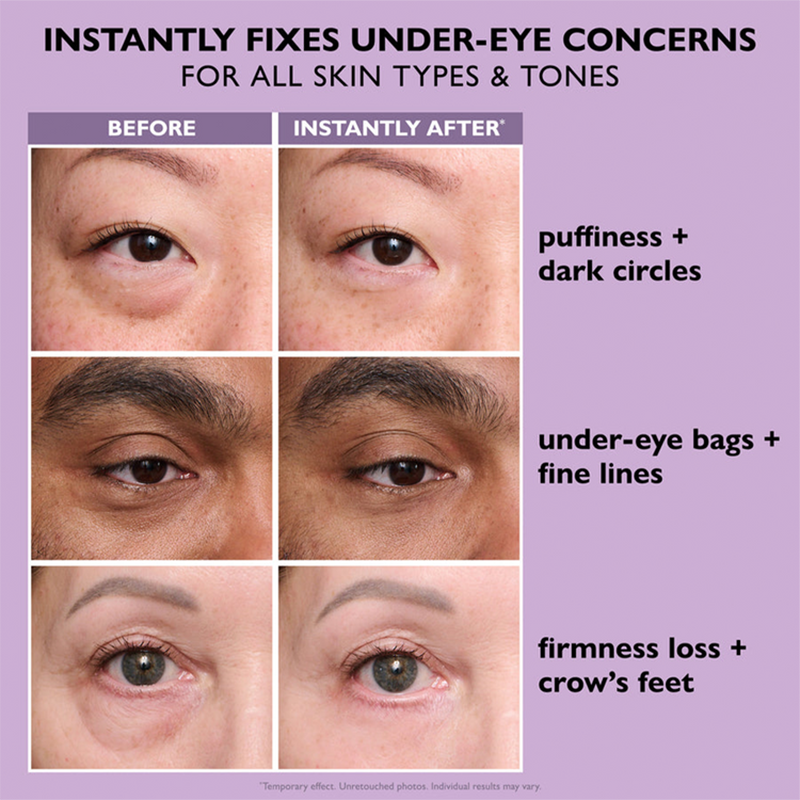 Instant Lift Eye Gel — Reduce the Look of Eye Bags in Minutes 🔥