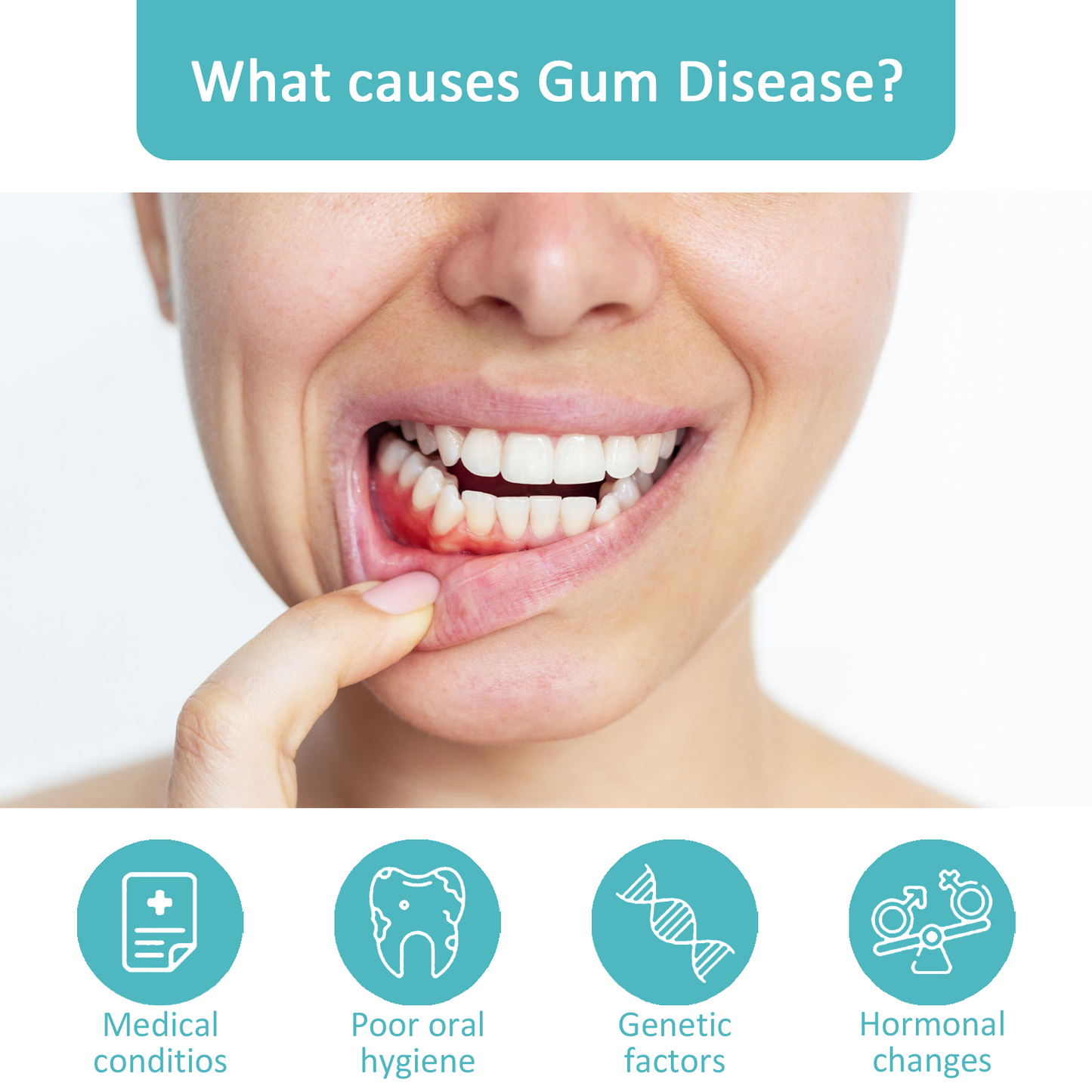 🦷🔥Last Day Promotion 80% OFF-NESLEMY™ Gum Shield Therapy Gel