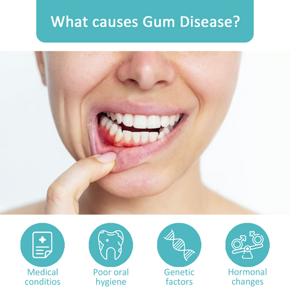 🦷🔥Last Day Promotion 80% OFF-NESLEMY™ Gum Shield Therapy Gel