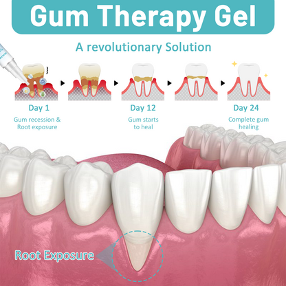 🦷🔥Last Day Promotion 80% OFF-NESLEMY™ Gum Shield Therapy Gel