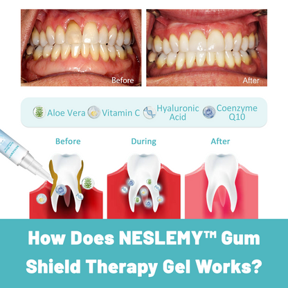 🦷🔥Last Day Promotion 80% OFF-NESLEMY™ Gum Shield Therapy Gel