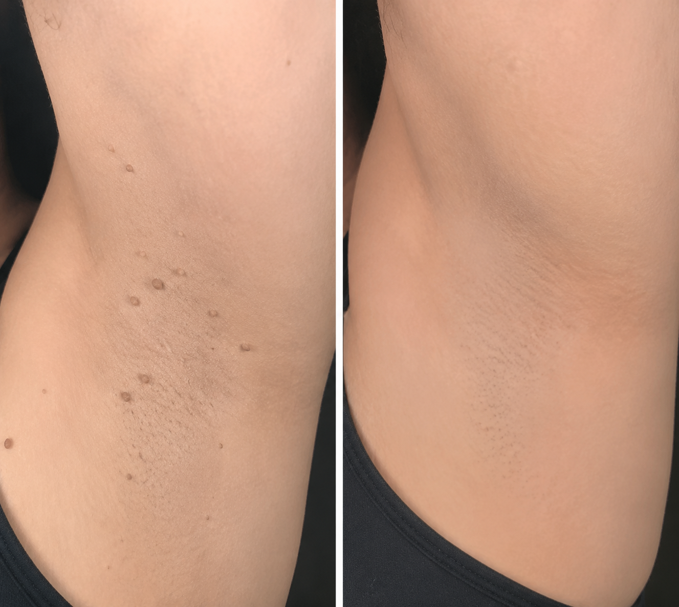 Skin Care Patches 🍀 | Hydrocolloid Daily Care Patches | Thin & Discreet Design | Comfortable Wear for Face & Body